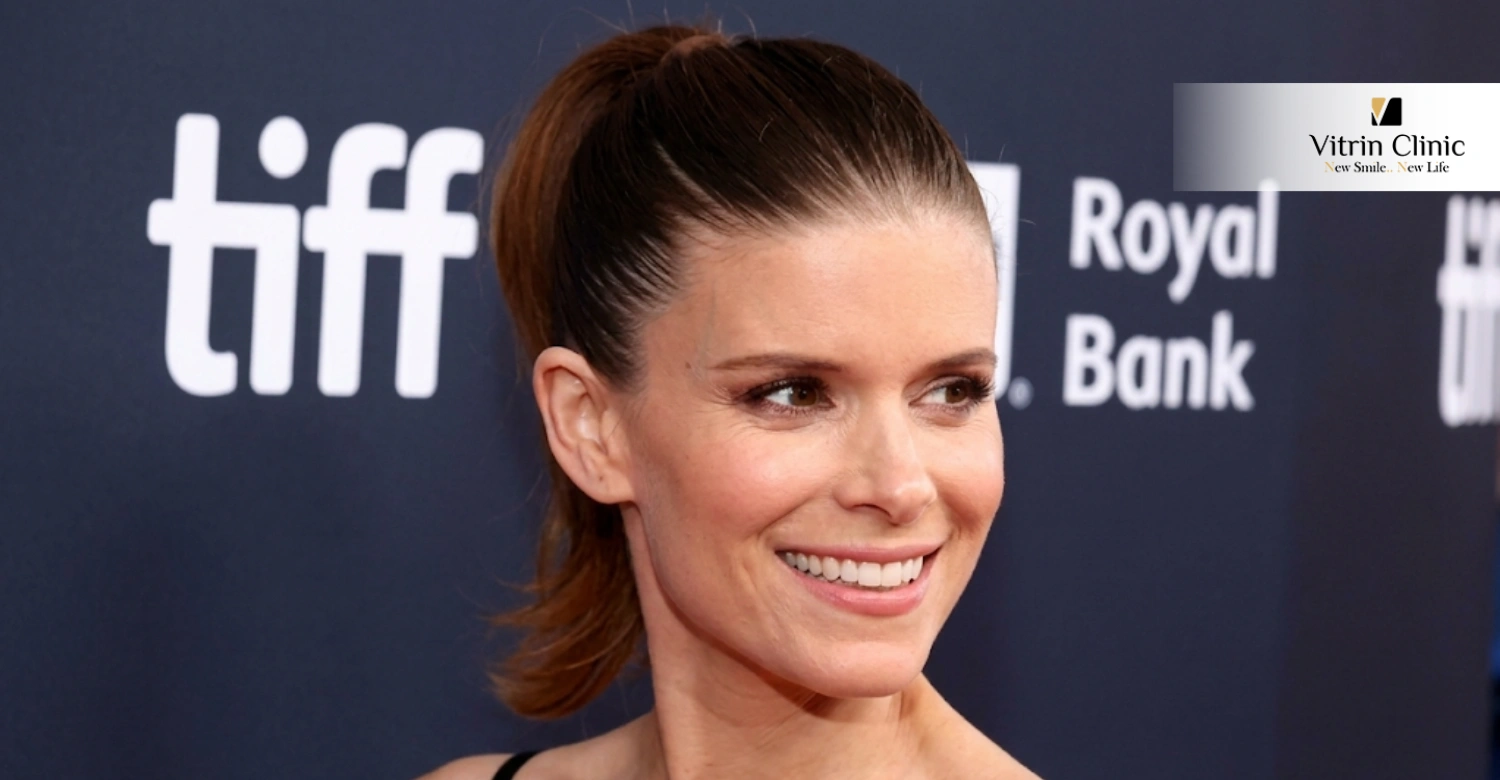 أسرار ابتسامة كيت مارا: احصلي على إطلالة هوليوود